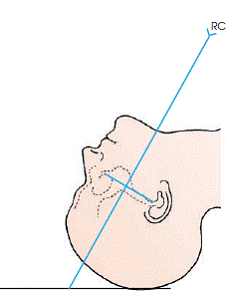 Tangential Projection